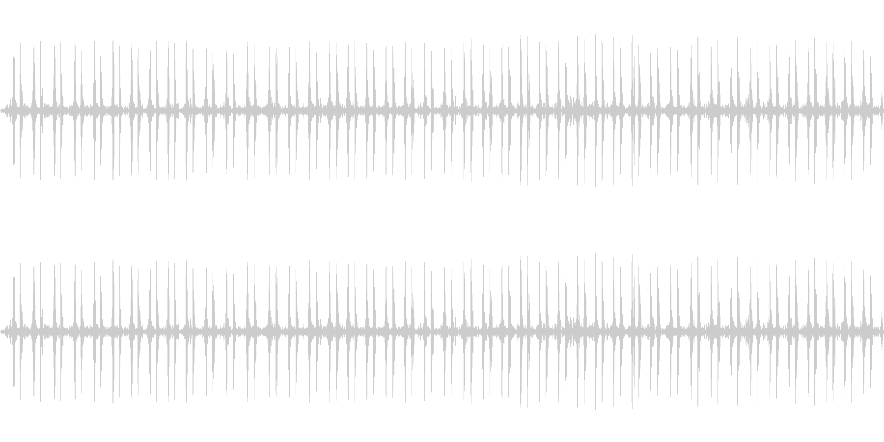 【特殊音】心臓の音の未再生の波形